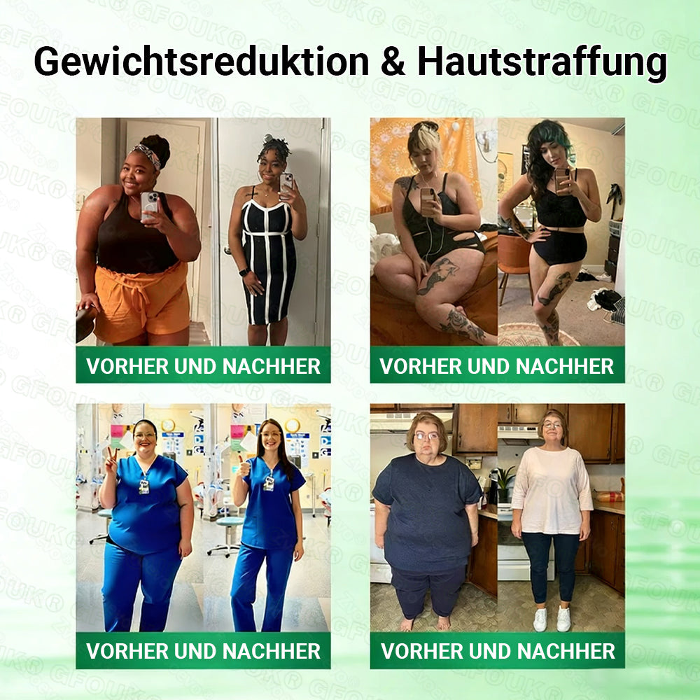 Offizieller Store 🇩🇪 |💖𝐆𝐅𝐎𝐔𝐊® Moringa · Berberin × NAD+ 10-in-1  Advanced Nano Mikronadel-Patch 🇩🇪 (Nur einmal täglich, sichtbare Veränderungen in 7 Tagen) ✅ Für Fettleibigkeit, schlaffe Haut, Diabetes, Schlafapnoe, Gelenkprobleme und mehr