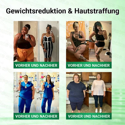 Offizieller Store 🇩🇪 |💖𝐆𝐅𝐎𝐔𝐊® Moringa · Berberin × NAD+ 10-in-1  Advanced Nano Mikronadel-Patch 🇩🇪 (Nur einmal täglich, sichtbare Veränderungen in 7 Tagen) ✅ Für Fettleibigkeit, schlaffe Haut, Diabetes, Schlafapnoe, Gelenkprobleme und mehr
