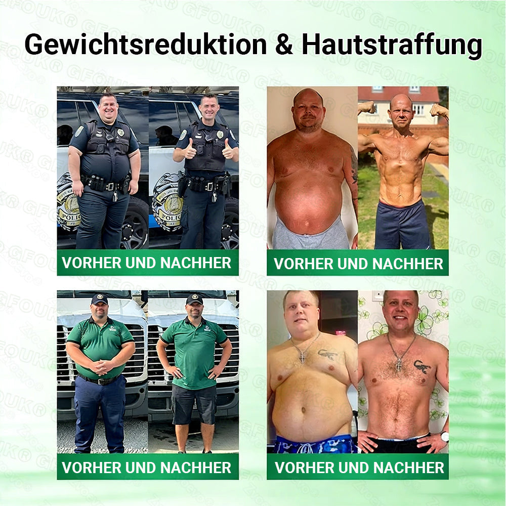 Offizieller Store 🇩🇪 |💖𝐆𝐅𝐎𝐔𝐊® Moringa · Berberin × NAD+ 10-in-1  Advanced Nano Mikronadel-Patch 🇩🇪 (Nur einmal täglich, sichtbare Veränderungen in 7 Tagen) ✅ Für Fettleibigkeit, schlaffe Haut, Diabetes, Schlafapnoe, Gelenkprobleme und mehr